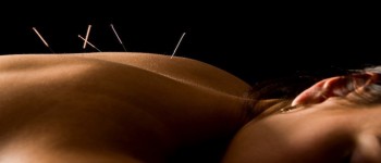 L'acupuncture dans le SII